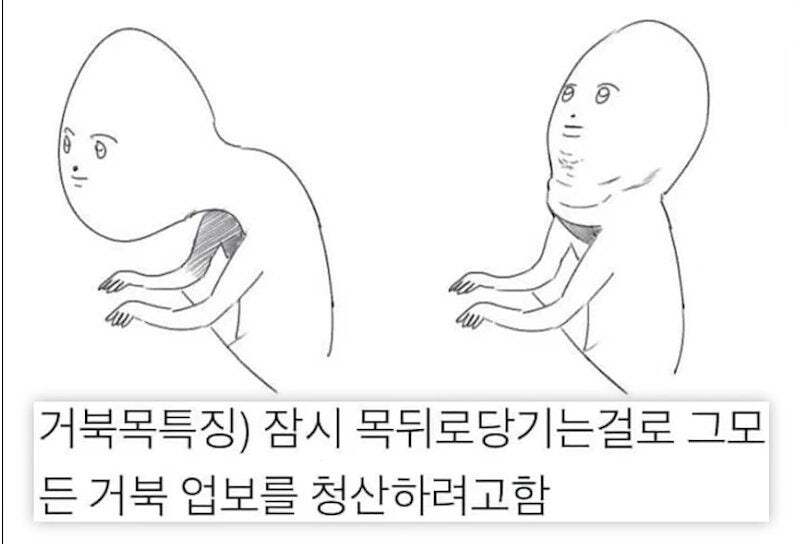 거북목인 사람 특징.jpg_1.jpg