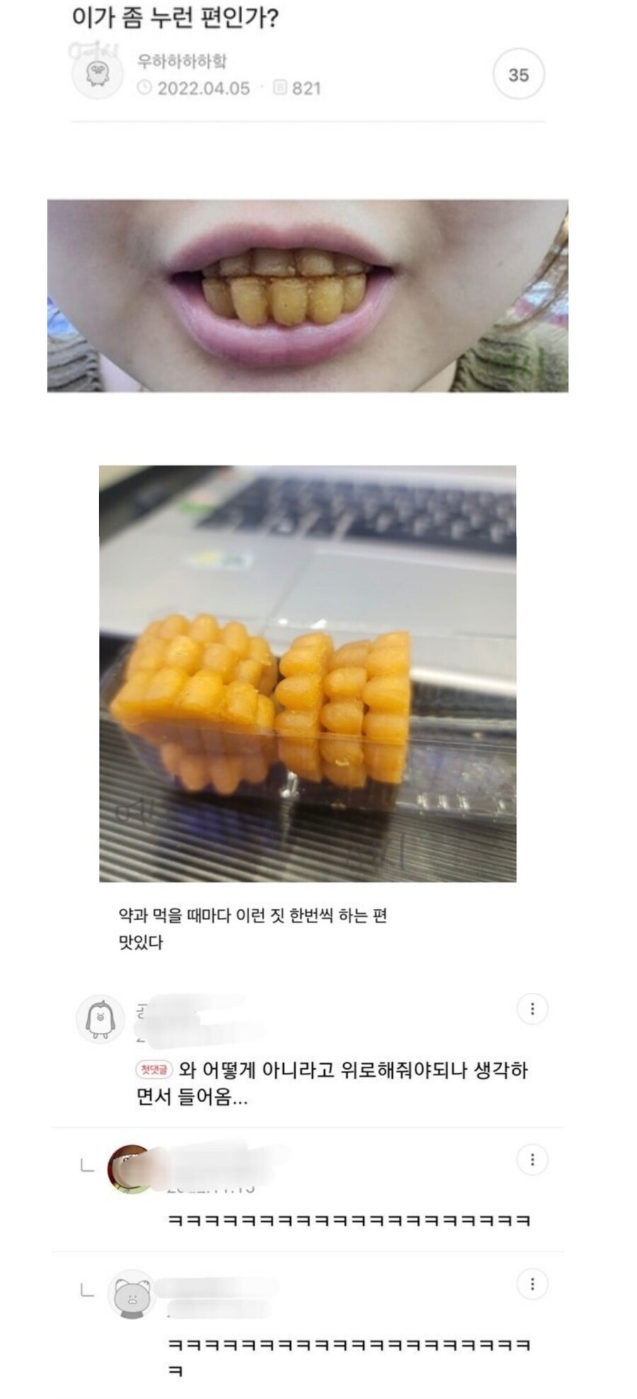 나 치아 색이 좀 누런편이야?_1.jpg