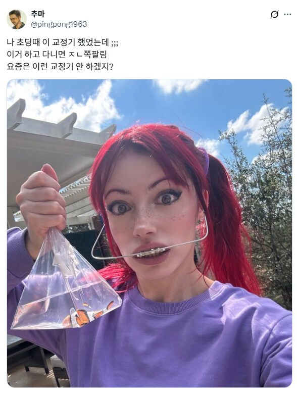 초딩때 이런 교정기 차고 다녔음.jpg_1.png