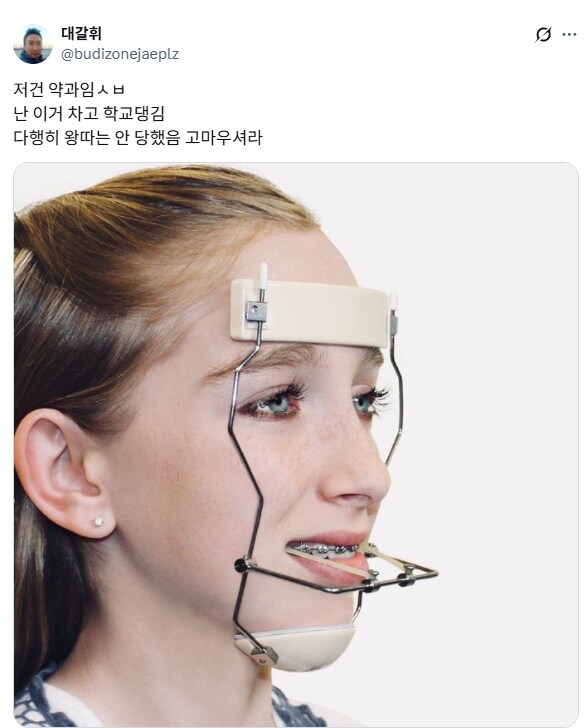 초딩때 이런 교정기 차고 다녔음.jpg_2.png
