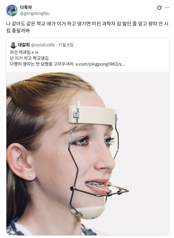초딩때 이런 교정기 차고 다녔음.jpg_3.png