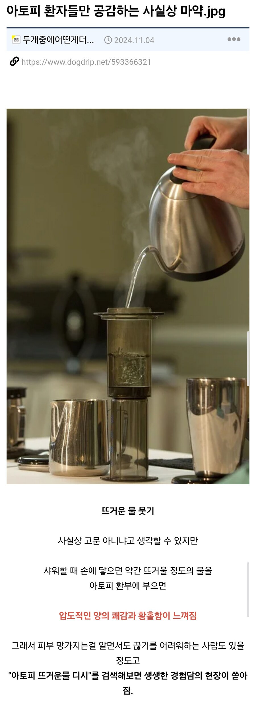 아토피 환자들만 공감하는 사실상 마1약...jpg_1.jpg