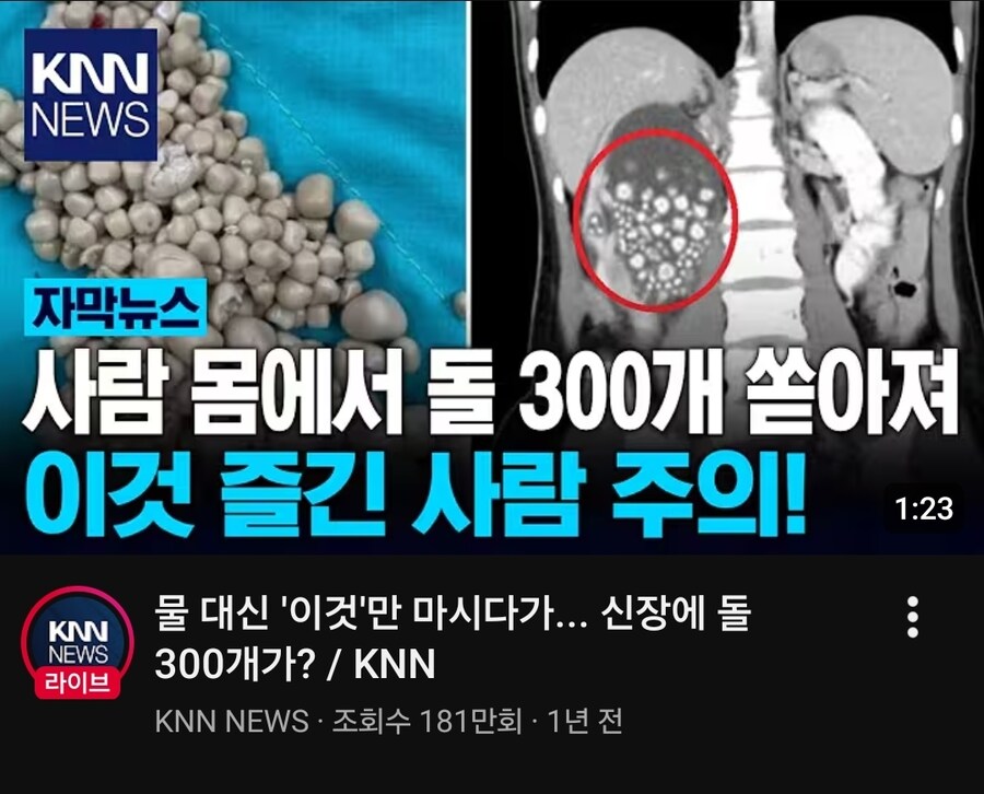 물 마셔야되는이유_1.jpg
