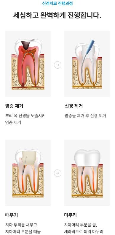 놀랍게도 마.약성 진통제or마취제 없던시절도 있었다는 수술_1.jpg