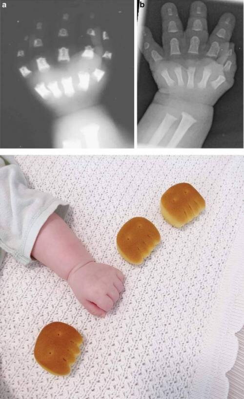 애기들이 통통한 이유.jpg_2.jpg