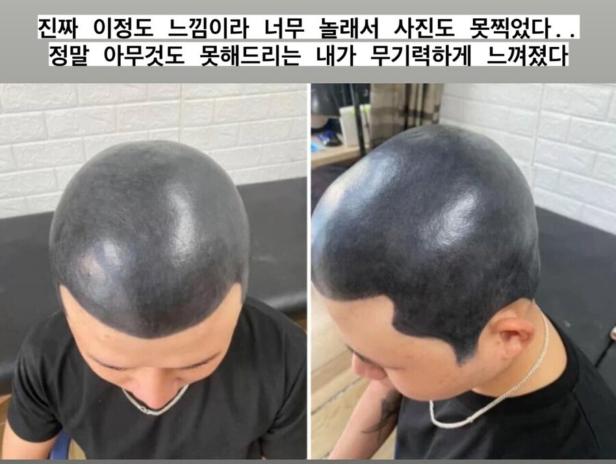 역대급으로 망해서 사진도 못 찍을 정도였다는 두피 문신.jpg_2.jpg