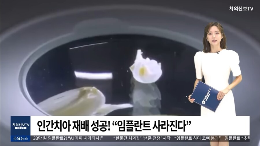 인간치아 재배 성공, 임플란트 사라진다_1.jpg