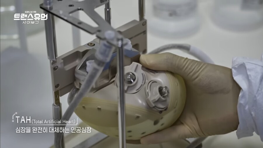 진짜로 작동하는 기계 심장_2.jpg
