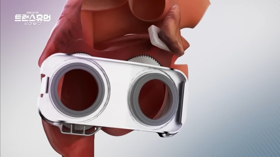 진짜로 작동하는 기계 심장_4.jpg