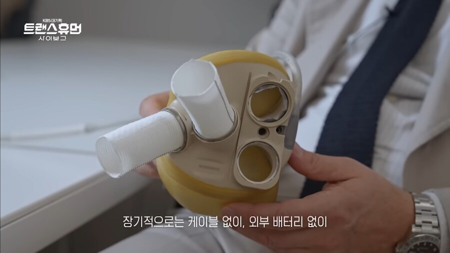 진짜로 작동하는 기계 심장_10.jpg
