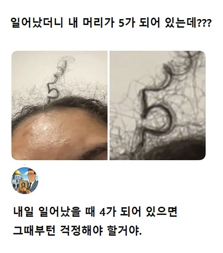 머리가 5가 된 남자_1.jpg