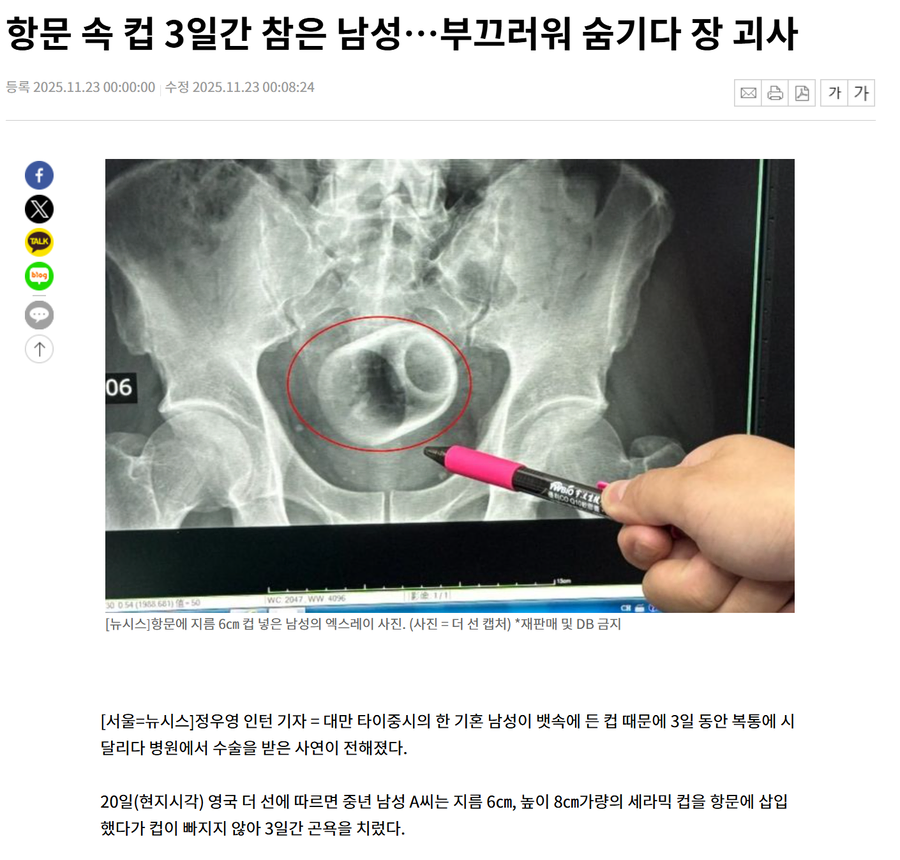 실수가 초래한 결과_1.webp