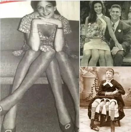 2개의 골반과 4개의 다리를 가진 여성_1.webp