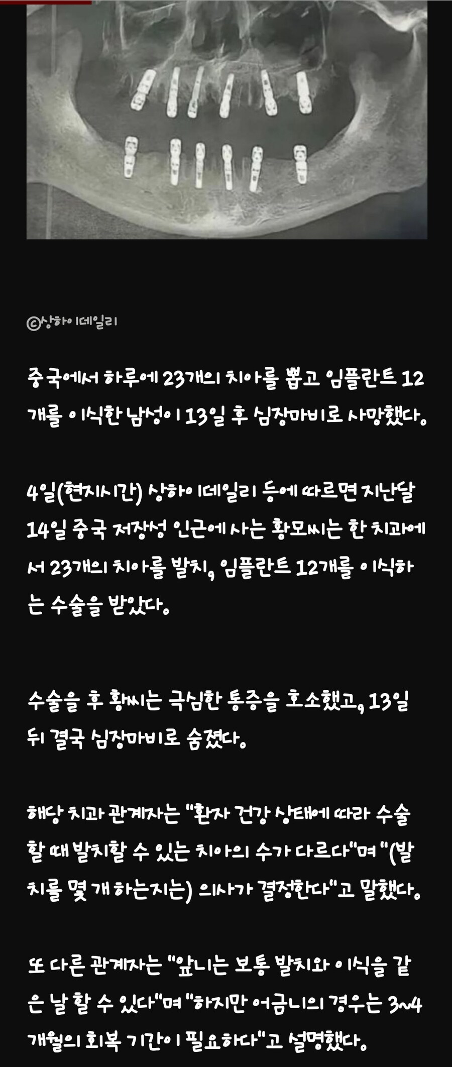 대륙의 발치 스케일_1.jpg