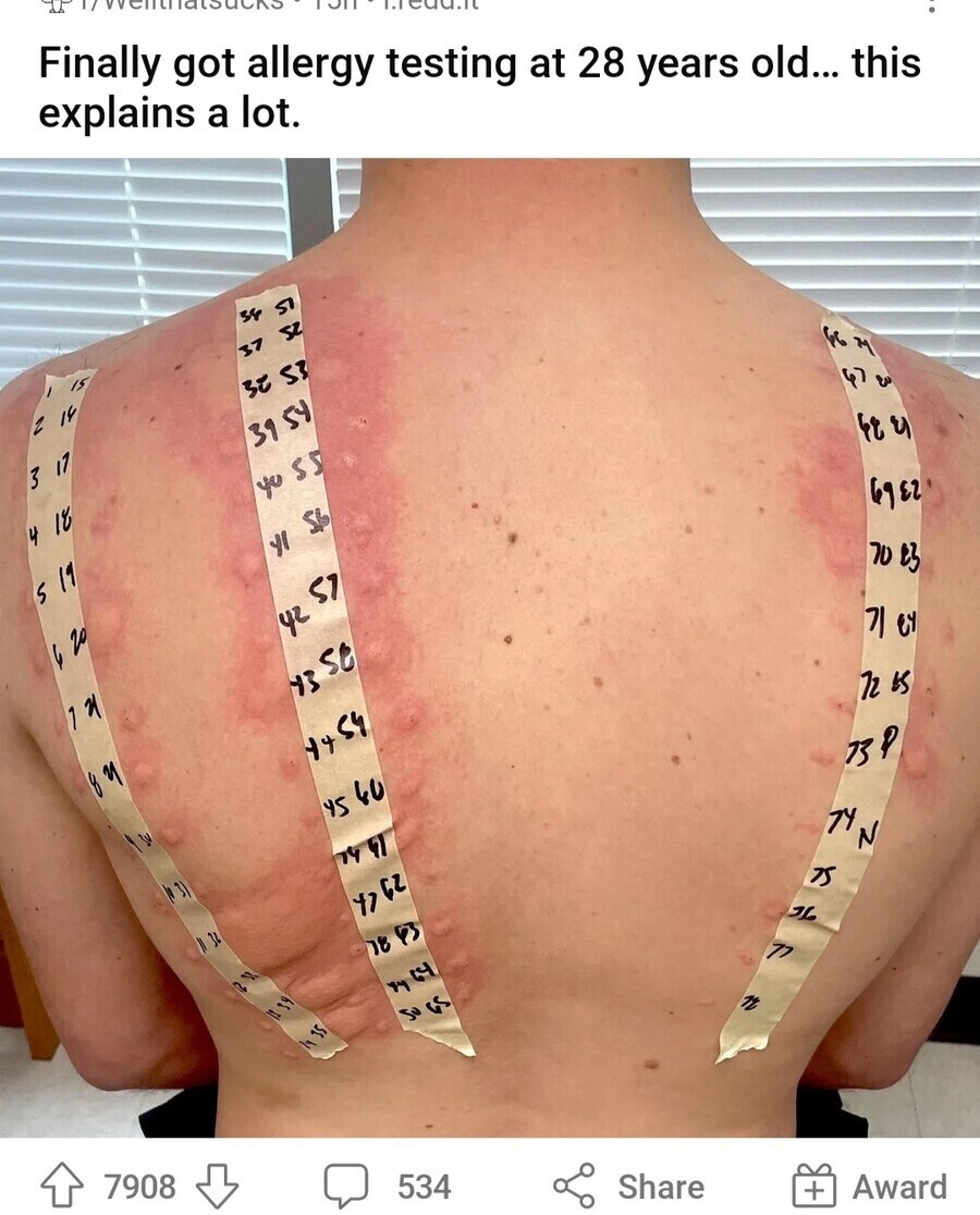 병원 : 어유 이 신에게 버림 받는 새끼..._1.jpg