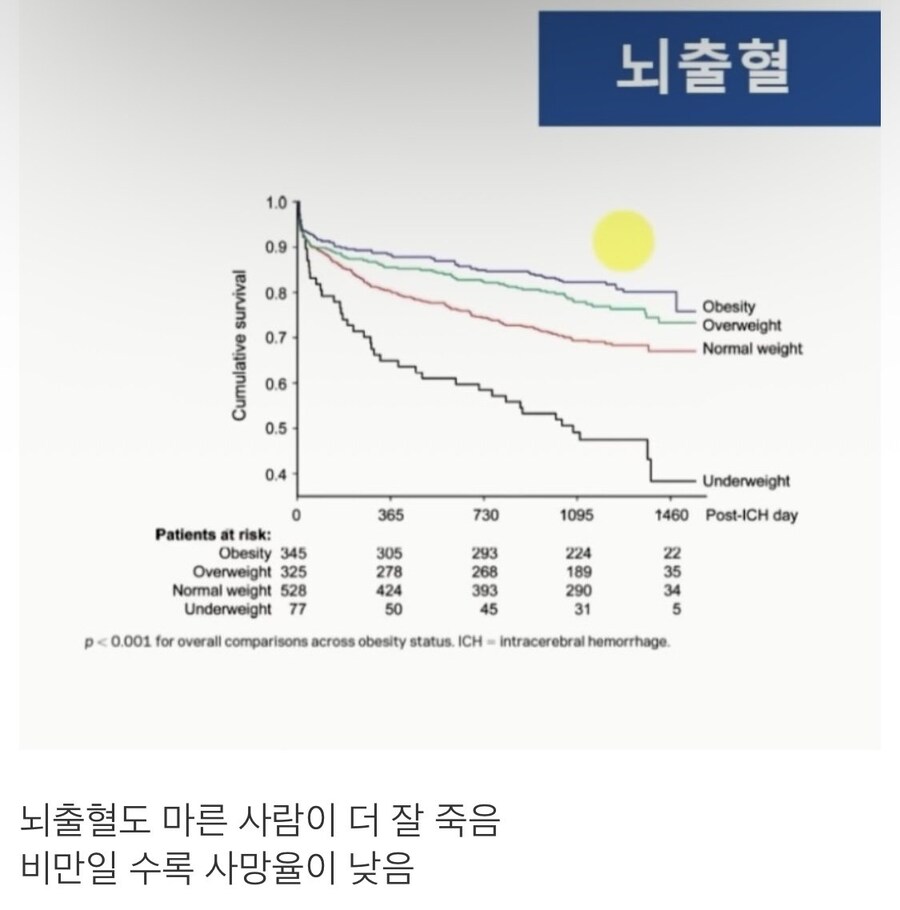 비만일수록 오히려 건강하고 장수한다는 서울대 교수.JPG_3.jpg