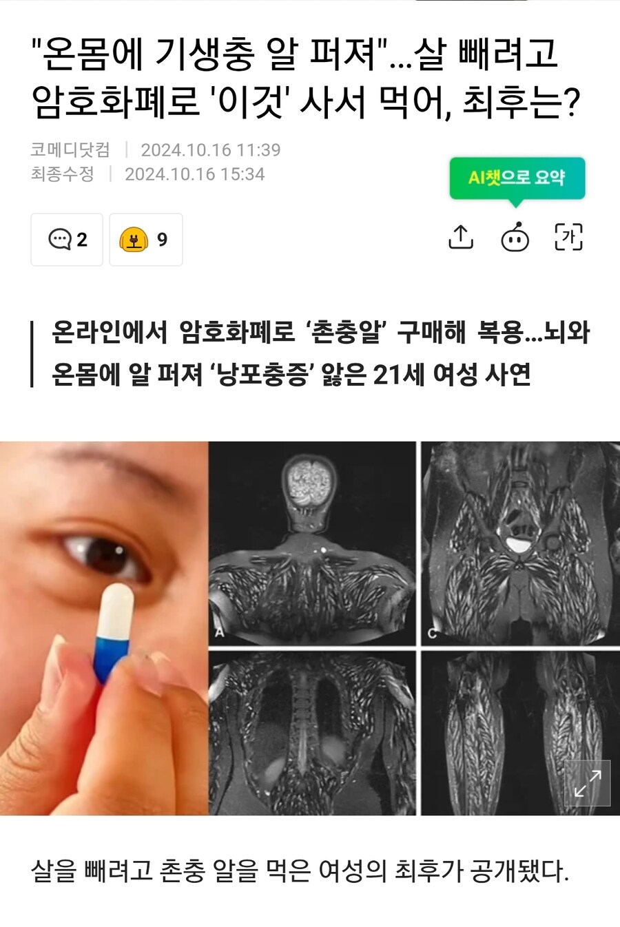 먹으면 진짜로 먹어도 살이 빠진다는약_1.jpg