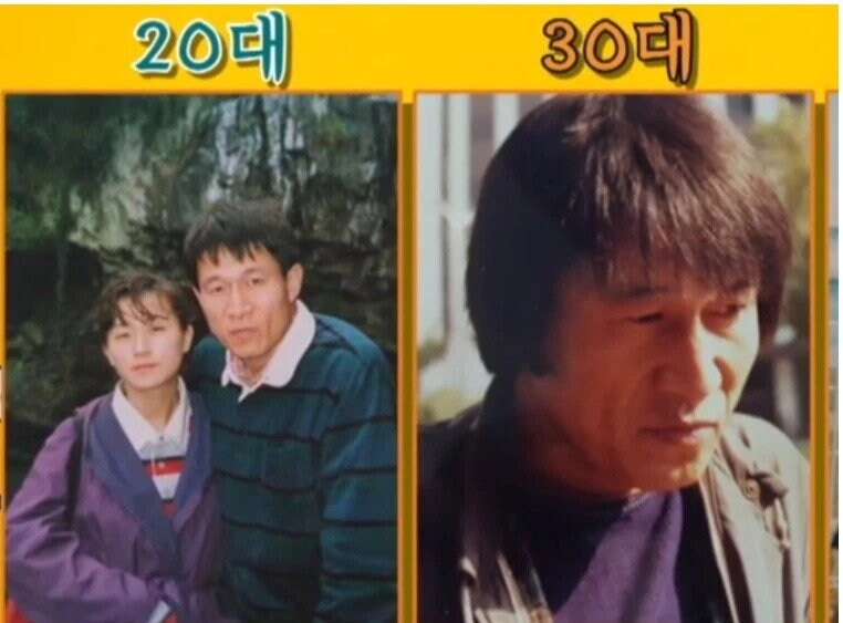 노안으로 유명했다는 연예인._3.jpg