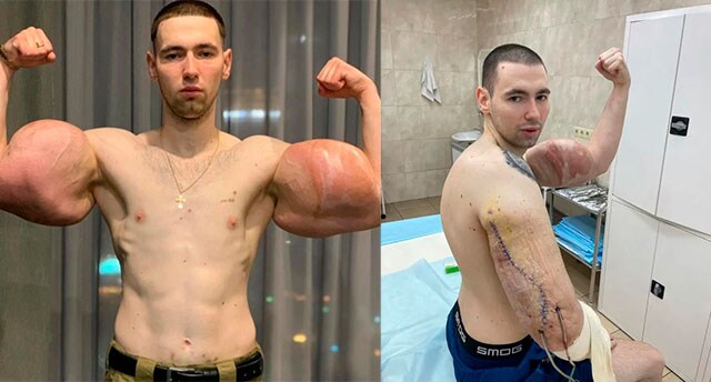 헬스) 약쓰는 케이스중에서도 제일 ㅄ취급받는거_1.png