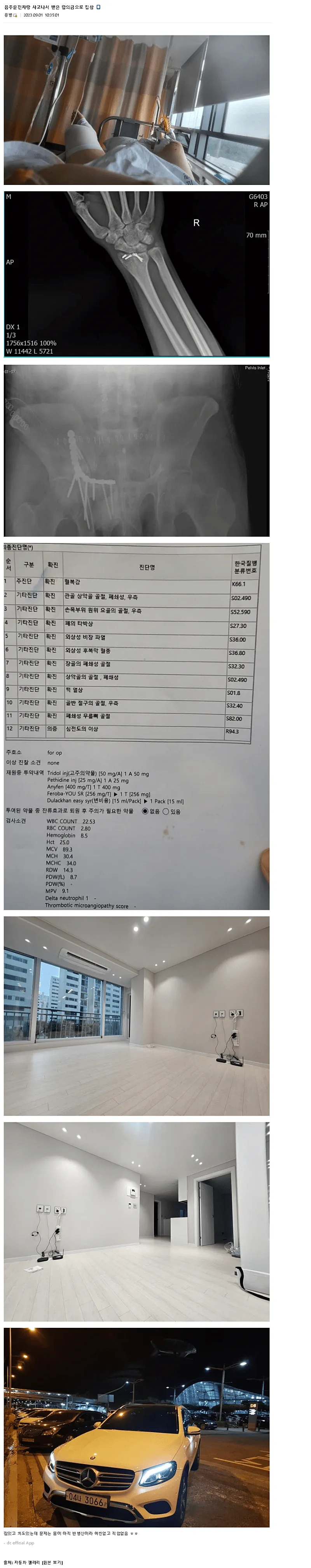 합의금으로 집, 벤츠 구매한 디씨인_1.webp