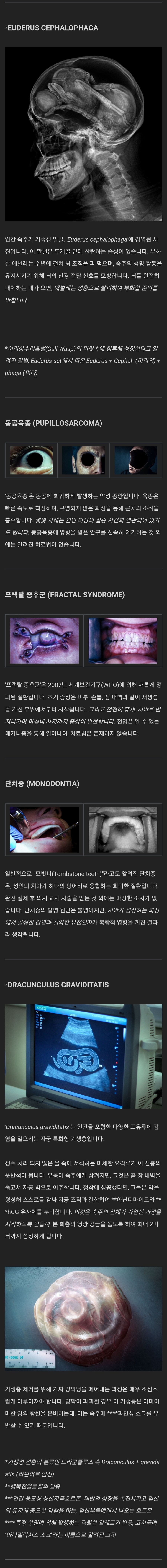 공포, 혐) 메디컬 호러.jpg_2.jpg