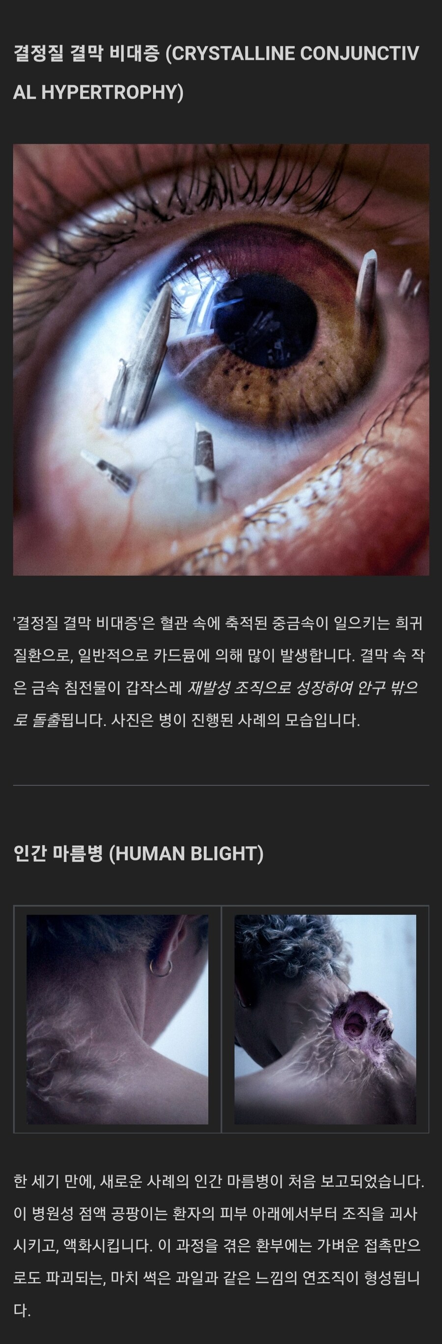 공포, 혐) 메디컬 호러.jpg_4.jpg