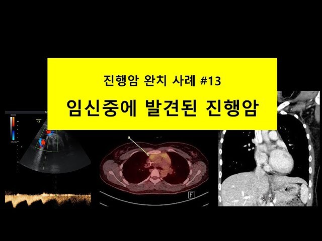 약혐) 현대 의술이 불가능한 것_1.jpg