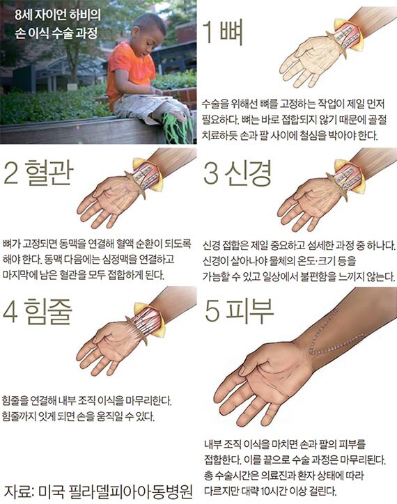 약혐) 현대 의술이 불가능한 것_2.jpg