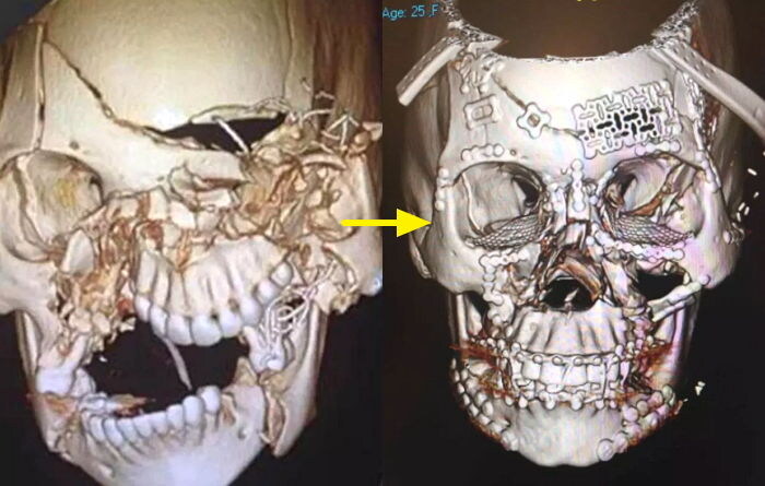 약혐) 현대 의술이 불가능한 것_3.jpg