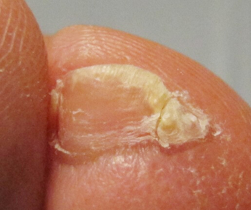 한국인 대부분 가지고 있는거_1.jpg