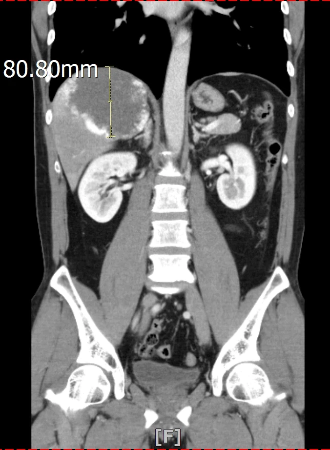 신기한 동물 속사진들_6.webp