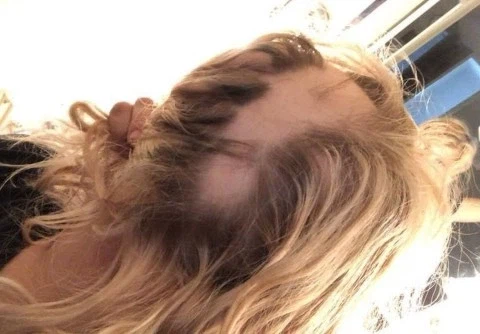 탈모 걸린 여친을 위해 가발을 만들어준 남친.jpg_1.webp