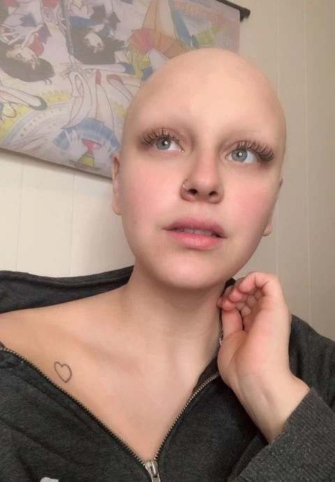 탈모 걸린 여친을 위해 가발을 만들어준 남친.jpg_2.webp