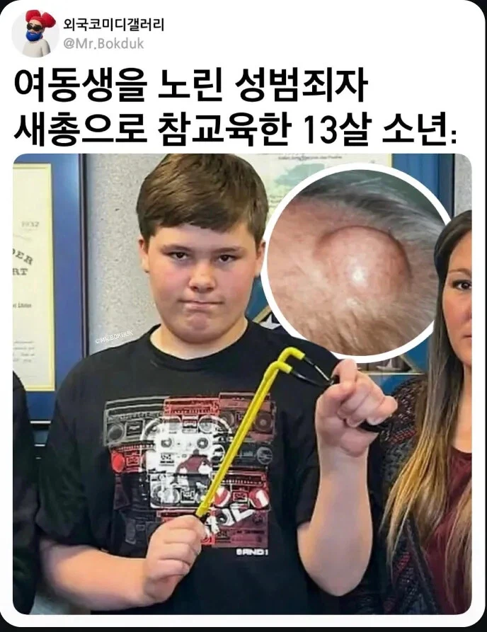 여동생 노린 성범죄자 새총으로 참교육한 13살 소년_1.webp