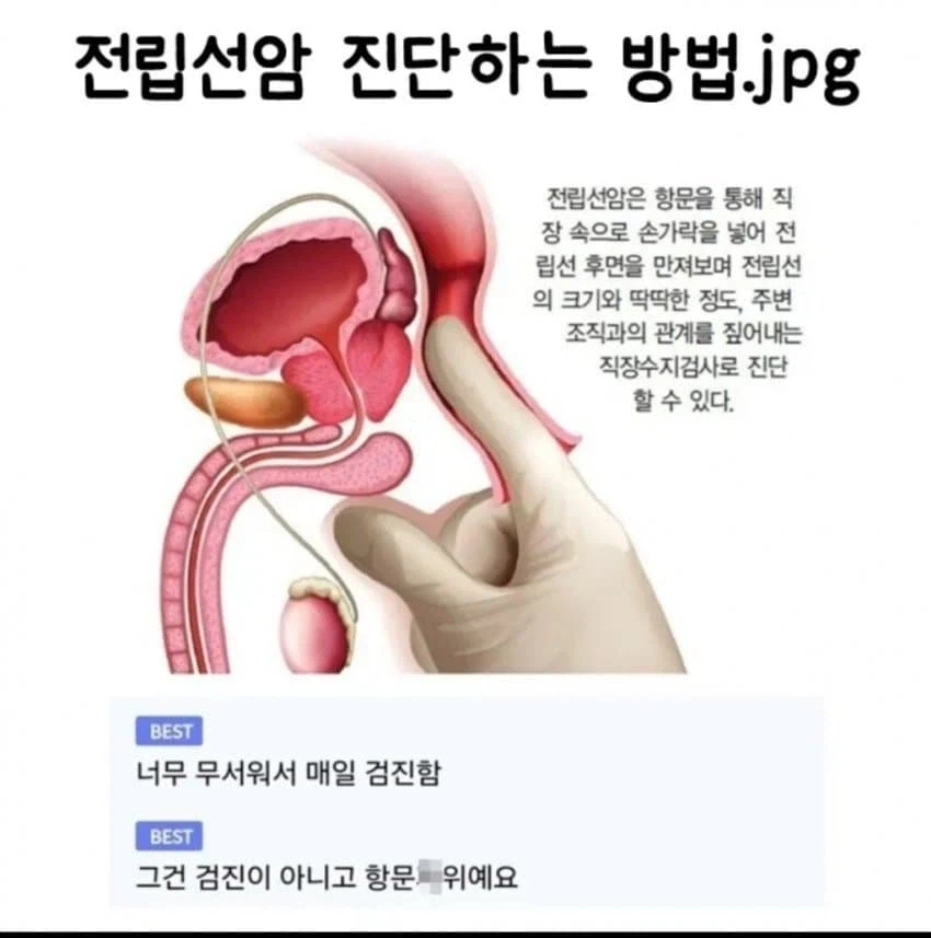 전립선 암 자가진단법_1.webp
