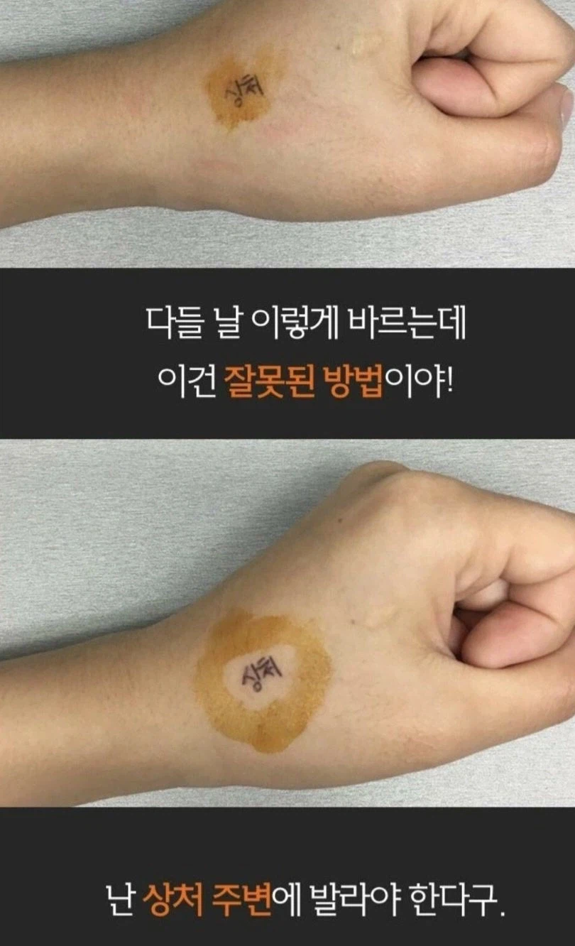 의사들 거품물게하는 짤.jpg_2.webp