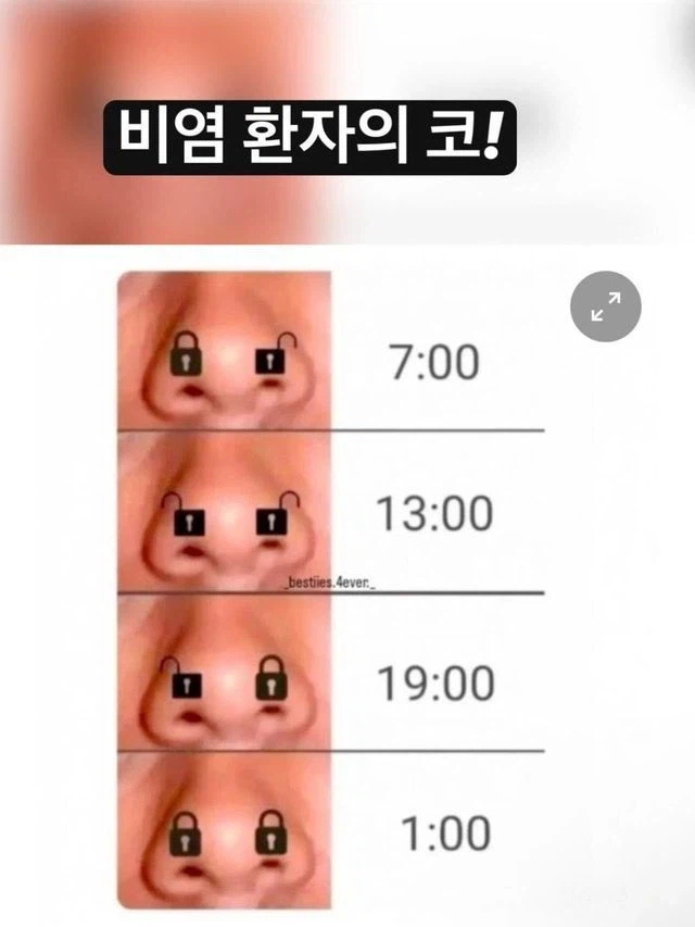 비염 환자 코의 시간표_1.webp