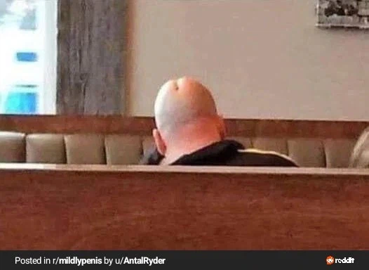 엉덩이턱의 반대말_1.webp