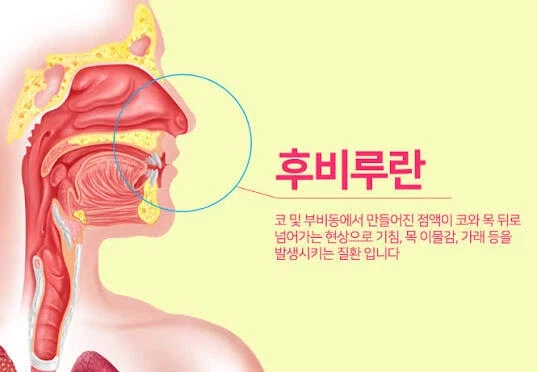 똑바로 누워자는걸 영구봉인당하게 만드는 무서운 질병_1.webp