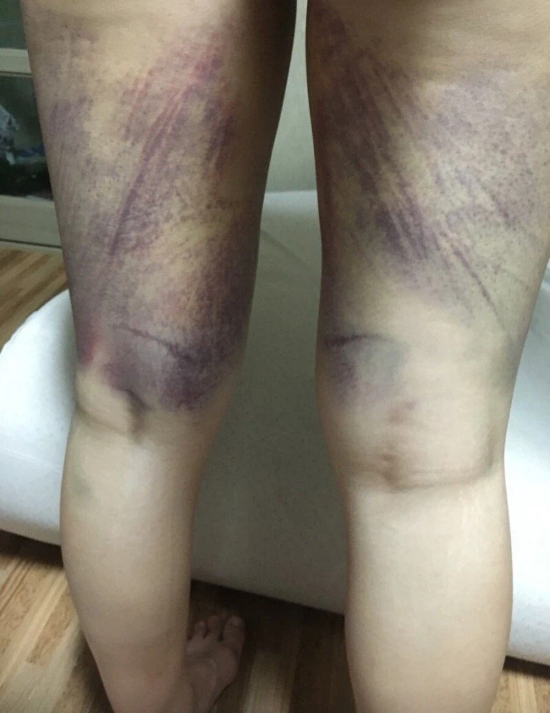 승마 운동의 엄청난 효과 jpg._4.webp