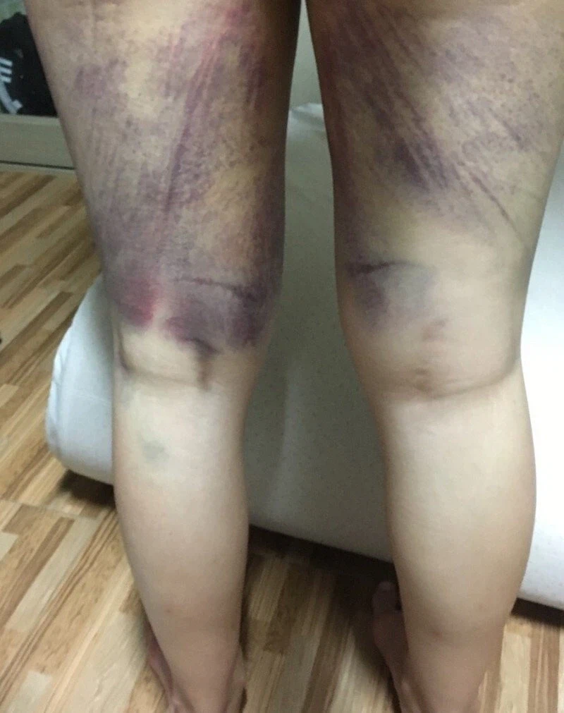 승마 운동의 엄청난 효과 jpg._5.webp