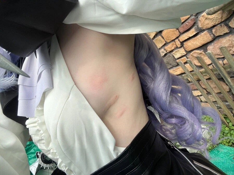 여름철 노출있는 복장 코스프레 할 때 단점_1.webp