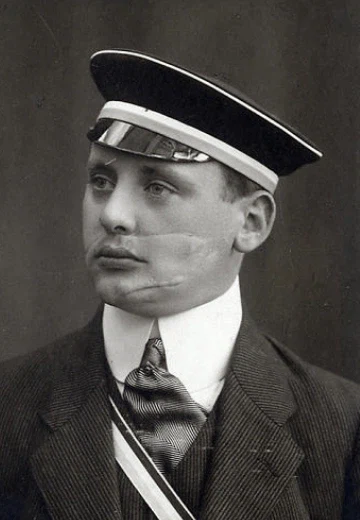 창작물에서 독일군 얼굴에 상처가 있는 이유_2.webp