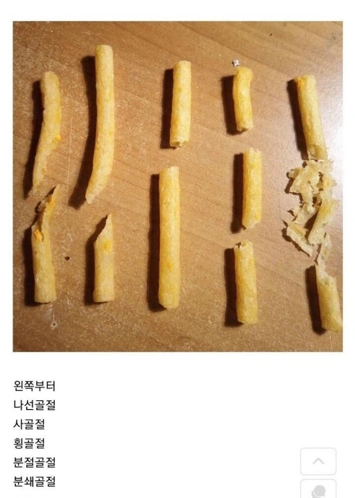진짜 겪으면 안되는 골절_1.webp