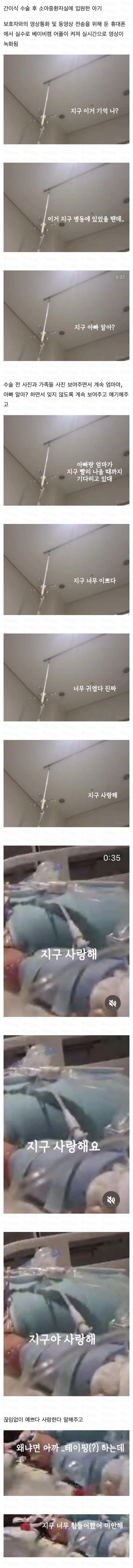 실수로 유출된 소아중환자실 영상_1.webp