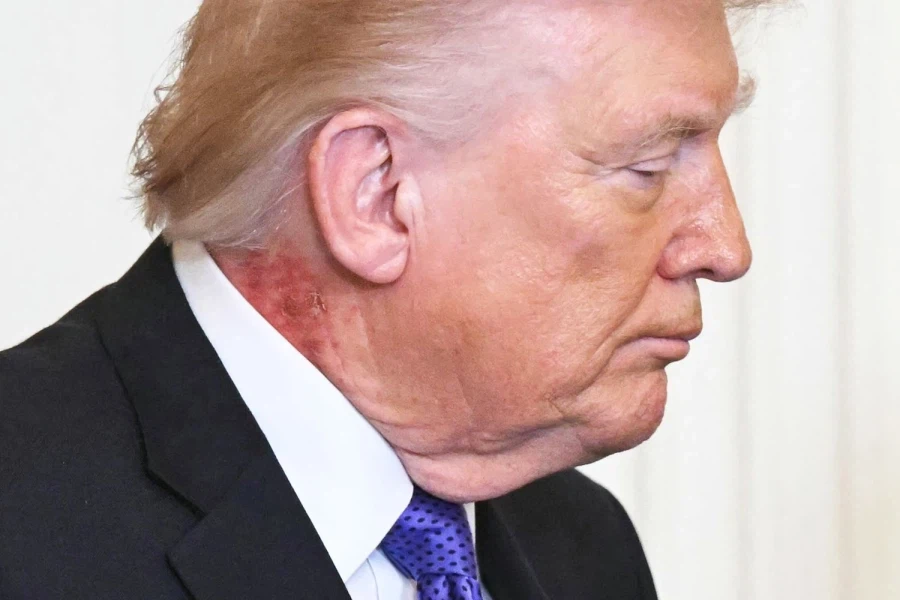 트럼프 좀비바이러스 감염설_1.webp