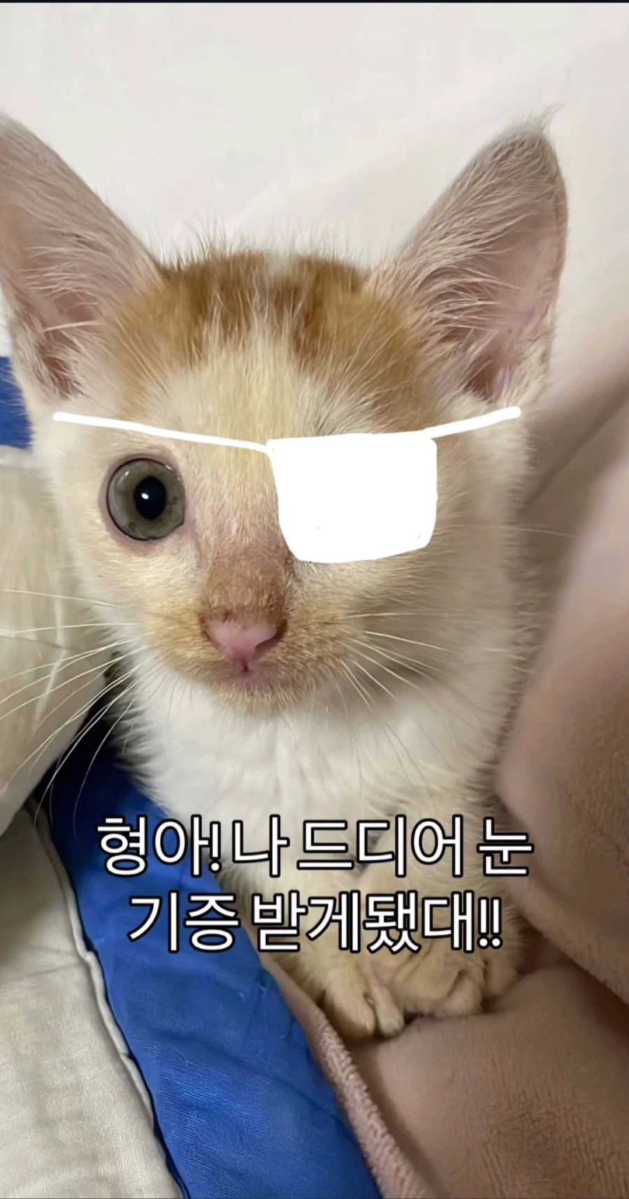 눈을 기증 받게된 애꾸 동생.jpg_1.webp