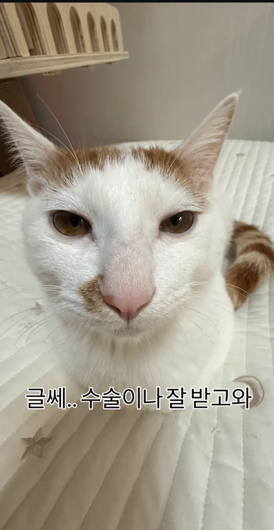 눈을 기증 받게된 애꾸 동생.jpg_4.webp