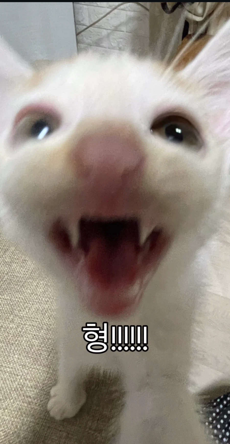 눈을 기증 받게된 애꾸 동생.jpg_8.webp