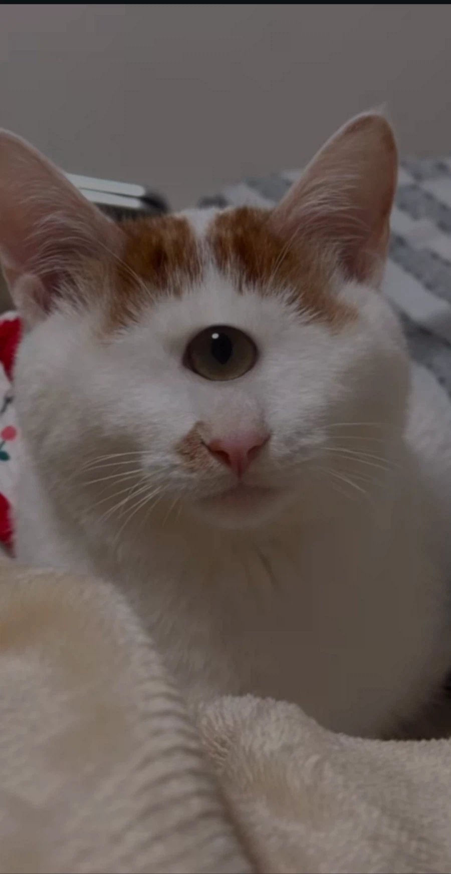 눈을 기증 받게된 애꾸 동생.jpg_9.webp